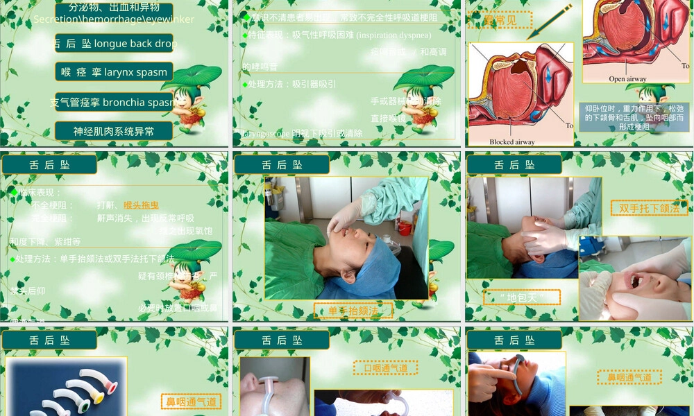 麻醉教学气道管理PPT课件.ppt