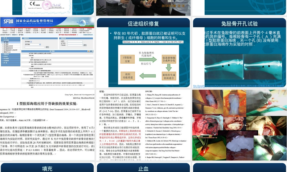 可即邦活性胶原止血材料口腔护理PPT课件.ppt