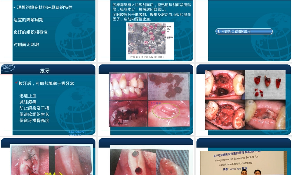 可即邦活性胶原止血材料口腔护理PPT课件.ppt