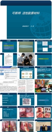 可即邦活性胶原止血材料口腔护理PPT课件.ppt