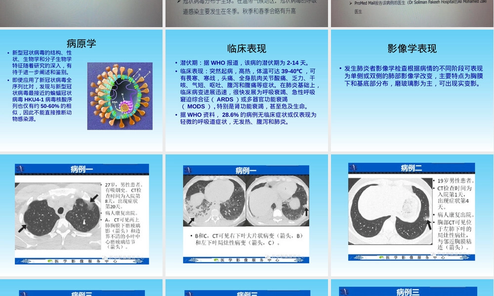 中东呼吸综合征诊疗与医院感染防控PPT课件.ppt
