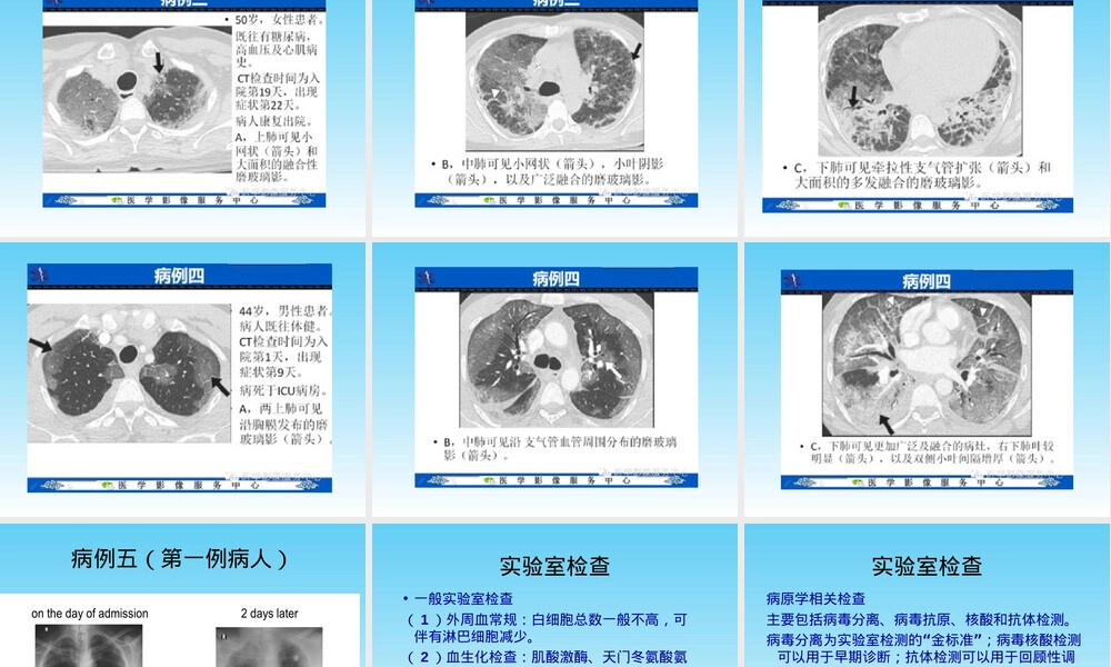 中东呼吸综合征诊疗与医院感染防控PPT课件.ppt