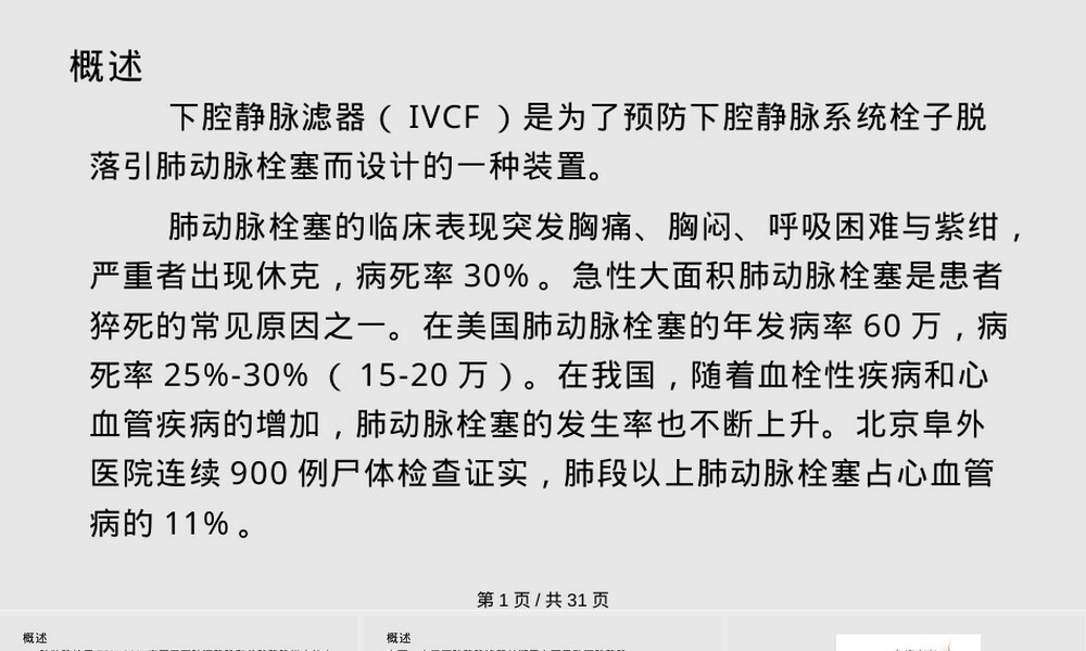 下腔静脉滤器植入与取出术规范PPT课件.pptx