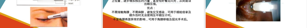 眼压测量护理管理PPT课件.pptx