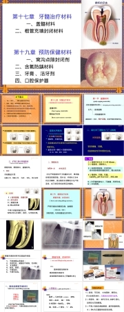 牙髓治疗材料PPT课件.ppt