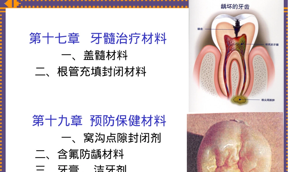 牙髓治疗材料PPT课件.ppt