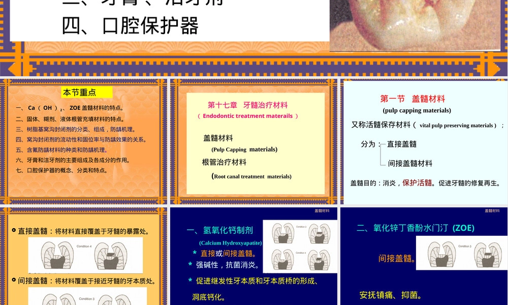 牙髓治疗材料PPT课件.ppt