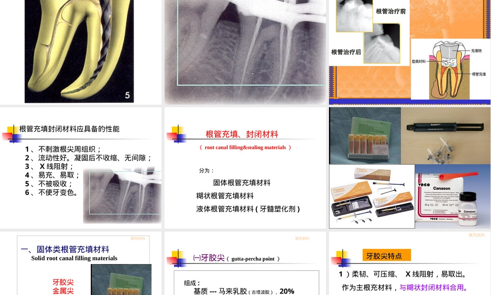 牙髓治疗材料PPT课件.ppt