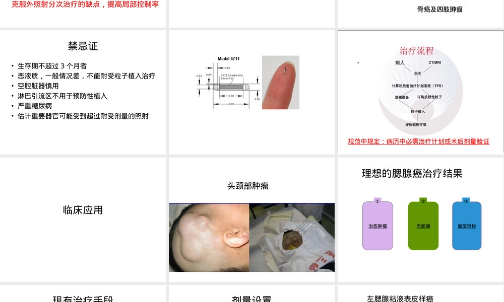 粒子植入演示讲解PPT课件,粒子植入治疗技术演示PPT课件.ppt