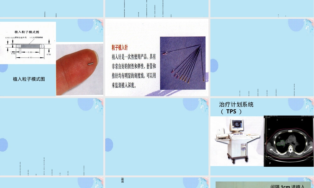 放射性粒子植入治疗肿瘤PPT课件.ppt