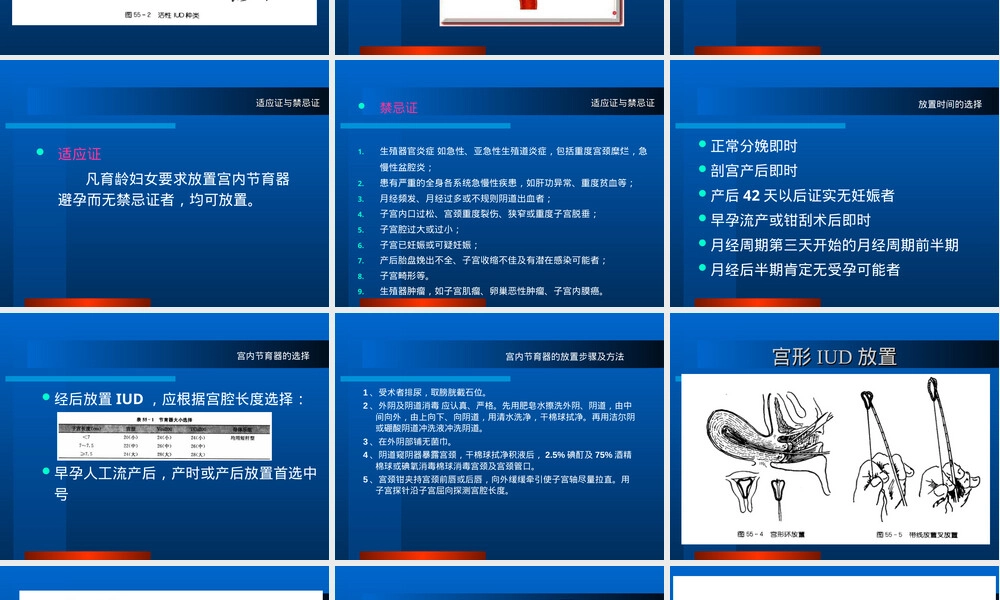 宫内节育器放置与取出术教学PPT课件.ppt