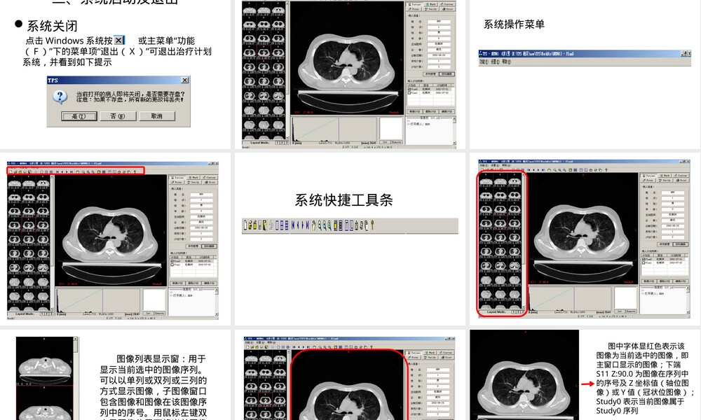 TPS放射性粒子植入治疗计划系统PPT课件.pptx