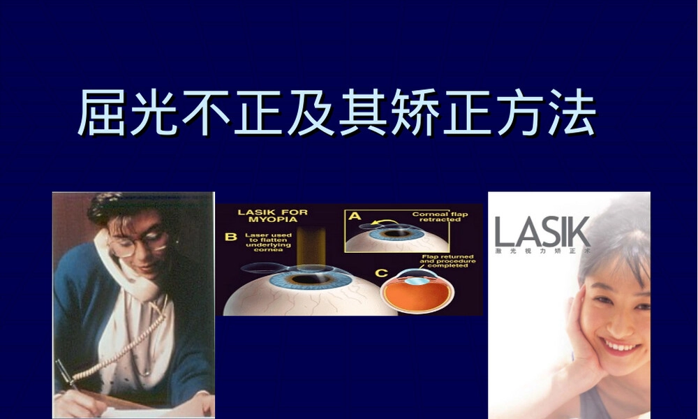 眼科学屈光不正及其矫正方法教学PPT课件.ppt