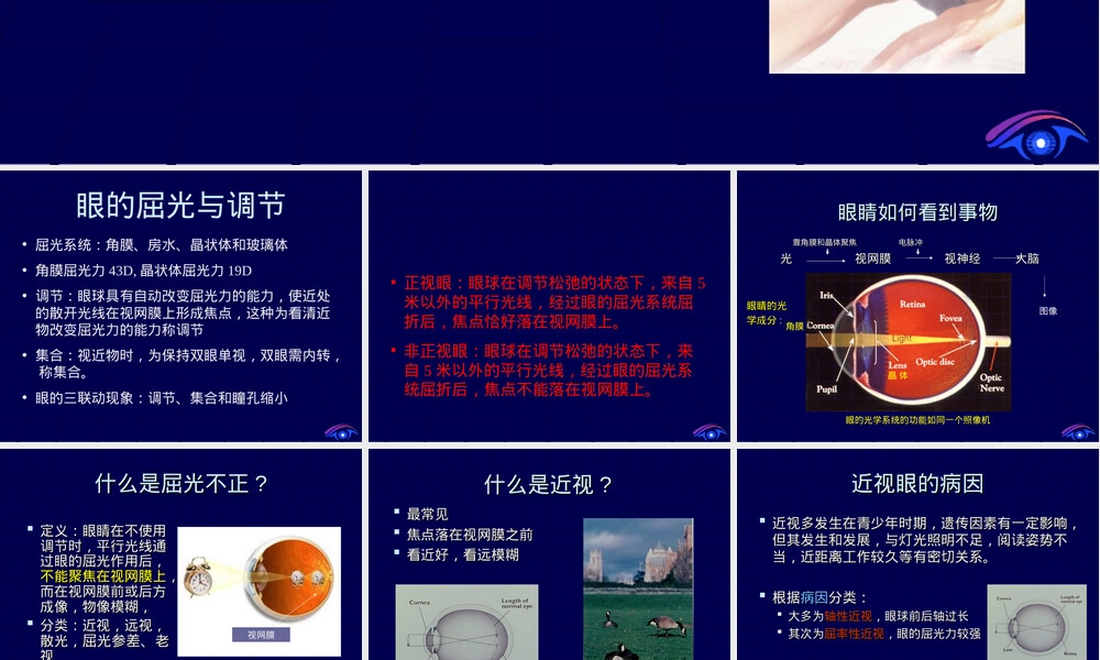 眼科学屈光不正及其矫正方法教学PPT课件.ppt
