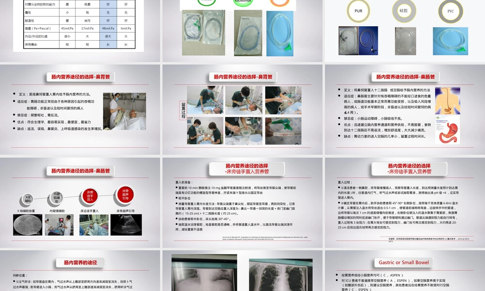 肠内营养途径建立与管理PPT课件.ppt