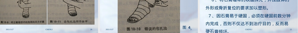 石膏绷带固定技术PPT课件.ppt