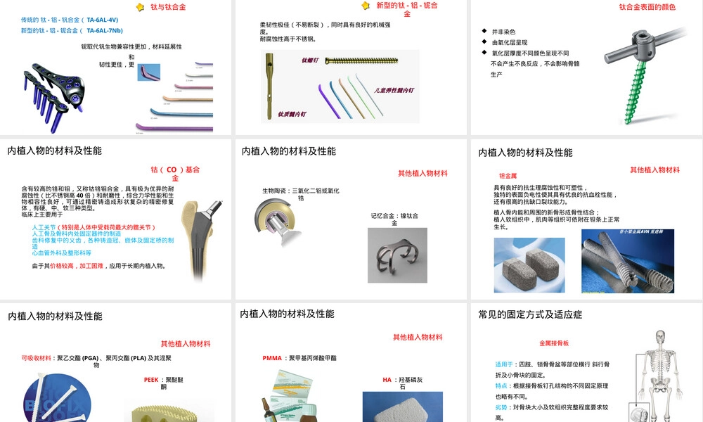 内固定材料性能与常见固定方式及适应症PPT课件.pptx