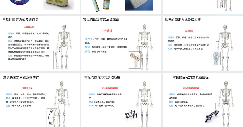 内固定材料性能与常见固定方式及适应症PPT课件.pptx