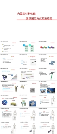 内固定材料性能与常见固定方式及适应症PPT课件.pptx