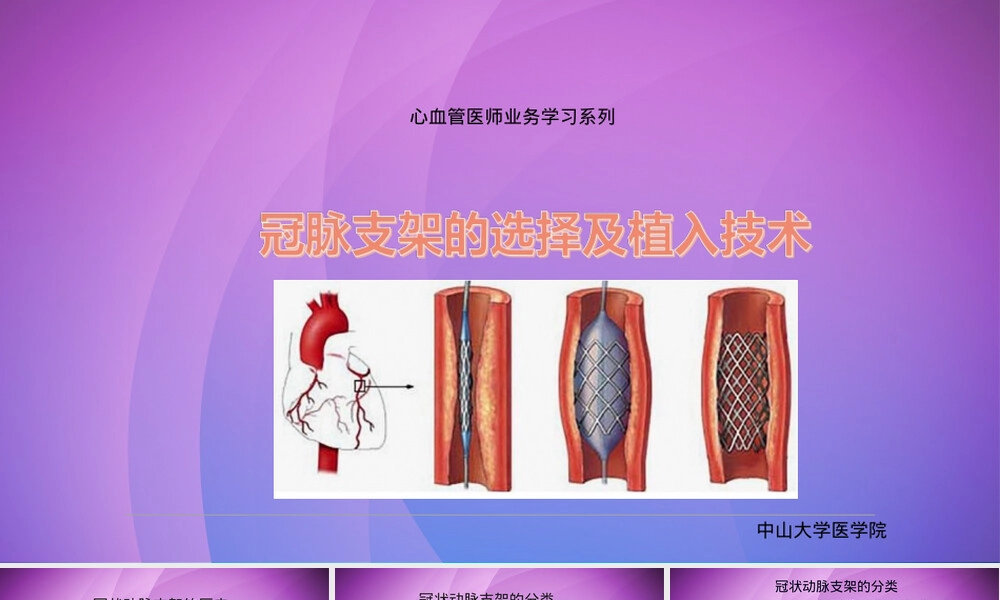 冠脉支架选择与植入技术教学PPT课件.ppt