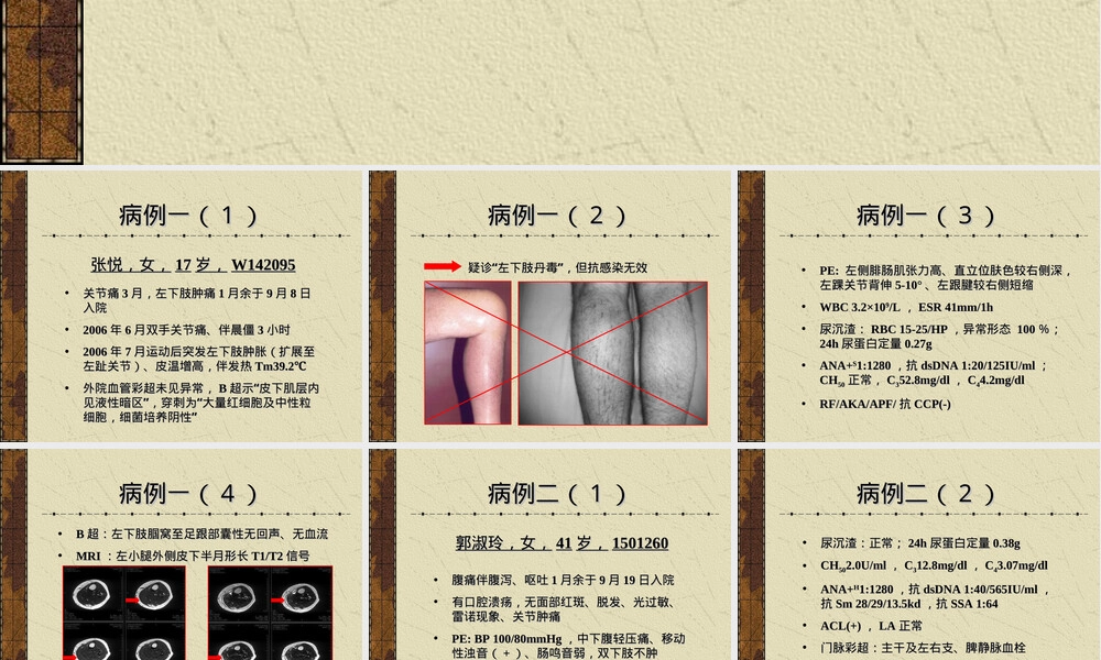病例汇报PPT课件 副本1.ppt