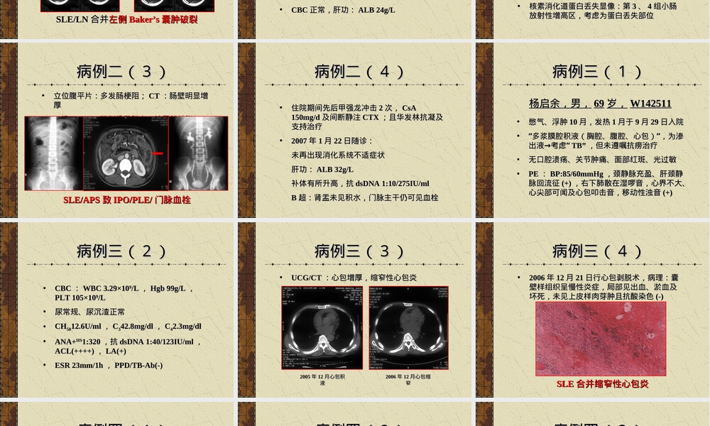 病例汇报PPT课件 副本1.ppt