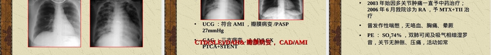病例汇报PPT课件 副本1.ppt