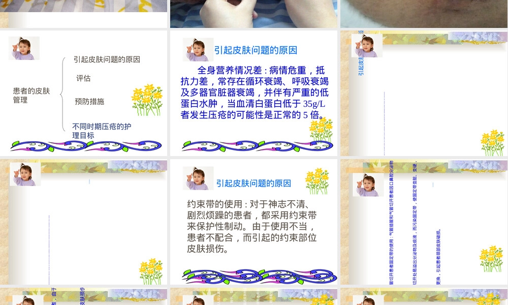 患者的皮肤管理PPT课件 副本1.ppt