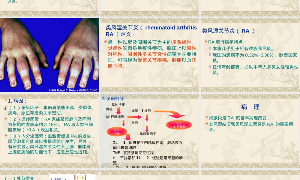 类风湿关节炎诊疗PPT课件.ppt
