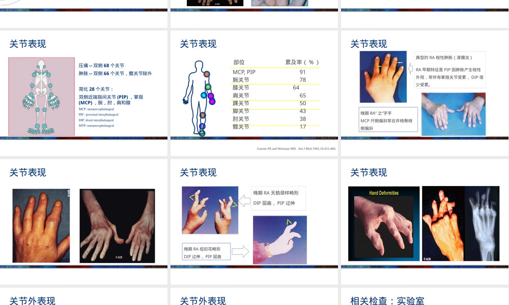 类风湿关节炎诊疗PPT课件含常用评分标准.pptx